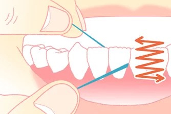 歯間ブラシ・フロス