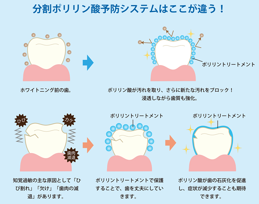 POINT4 「歯質強化」による虫歯予防の効果